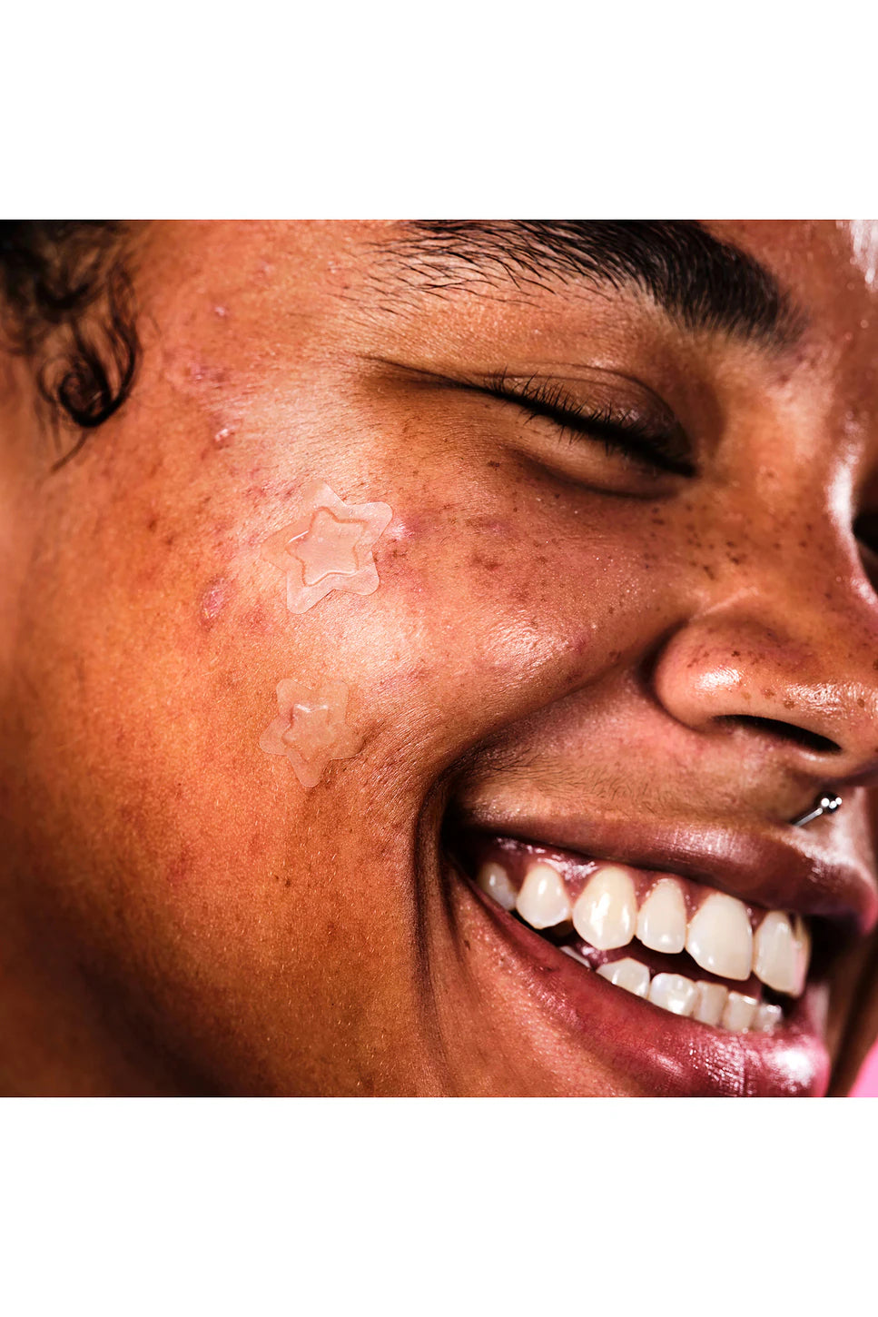 New Starface | Hydro Star Clear Pimple Patches | 32 parches