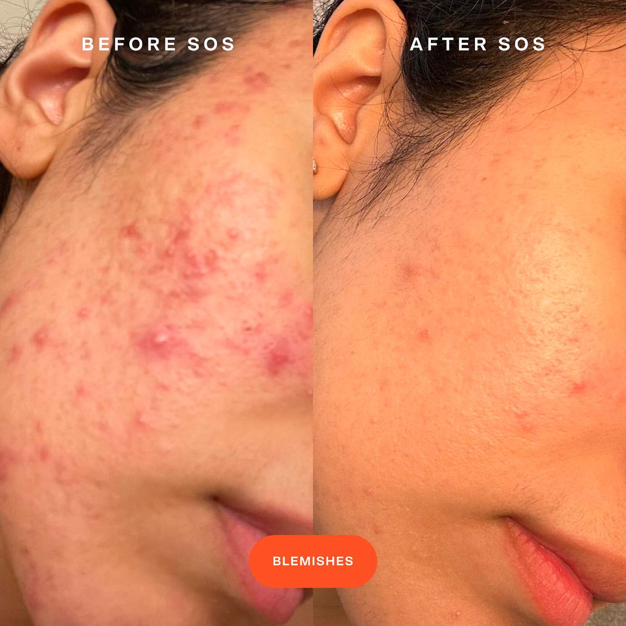 Mini SOS Daily Rescue Facial Spray with Hypochlorous Acid