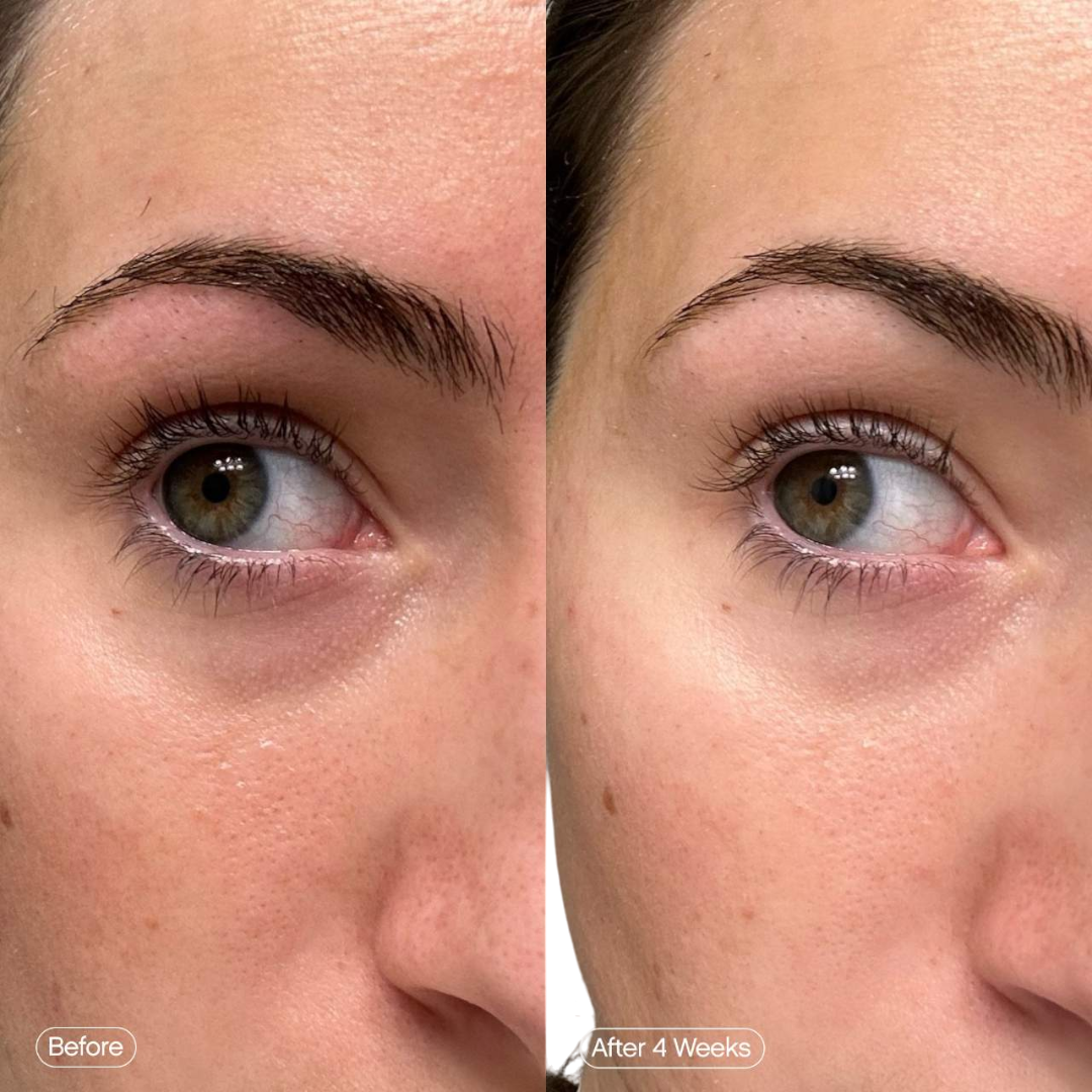 Topicals | Faded Under Eye Brightening & Clearing Eye Masks