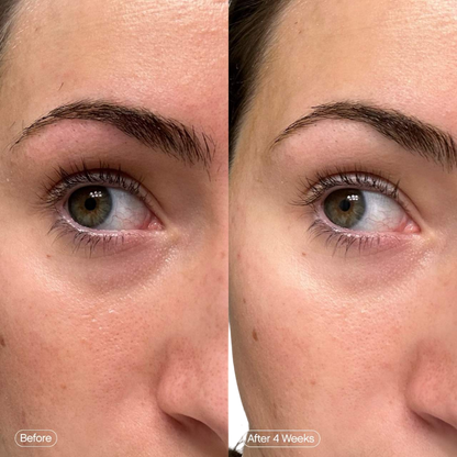 Topicals | Faded Under Eye Brightening & Clearing Eye Masks